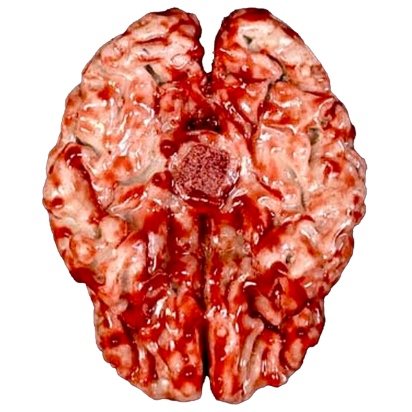 Realistic Urethane Bloody Brain Prop Online Hot Sale - Image 3